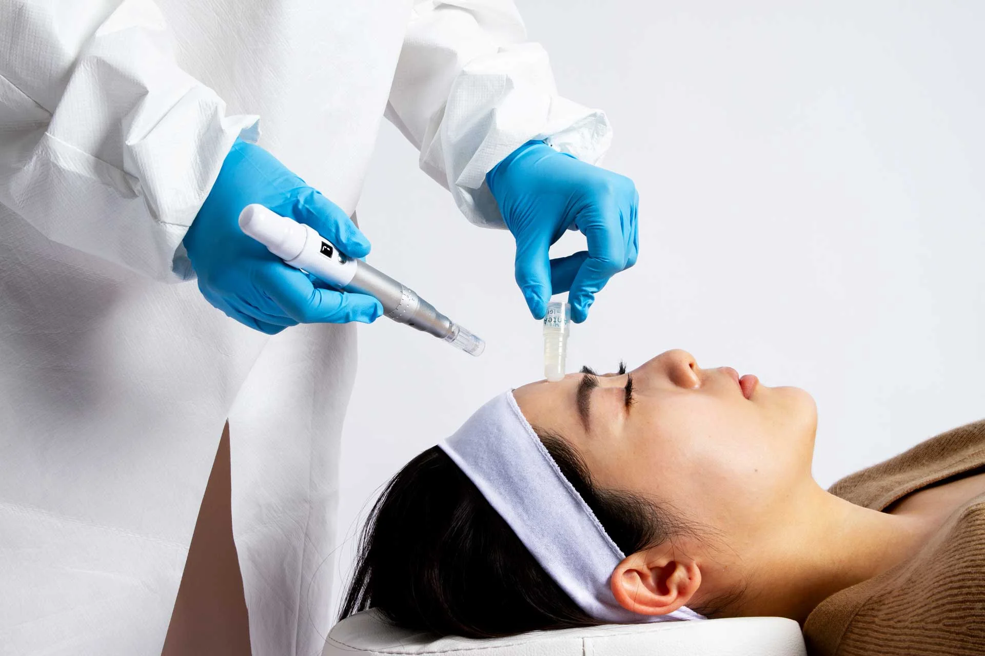 RF Microneedling with Exosomes treatment