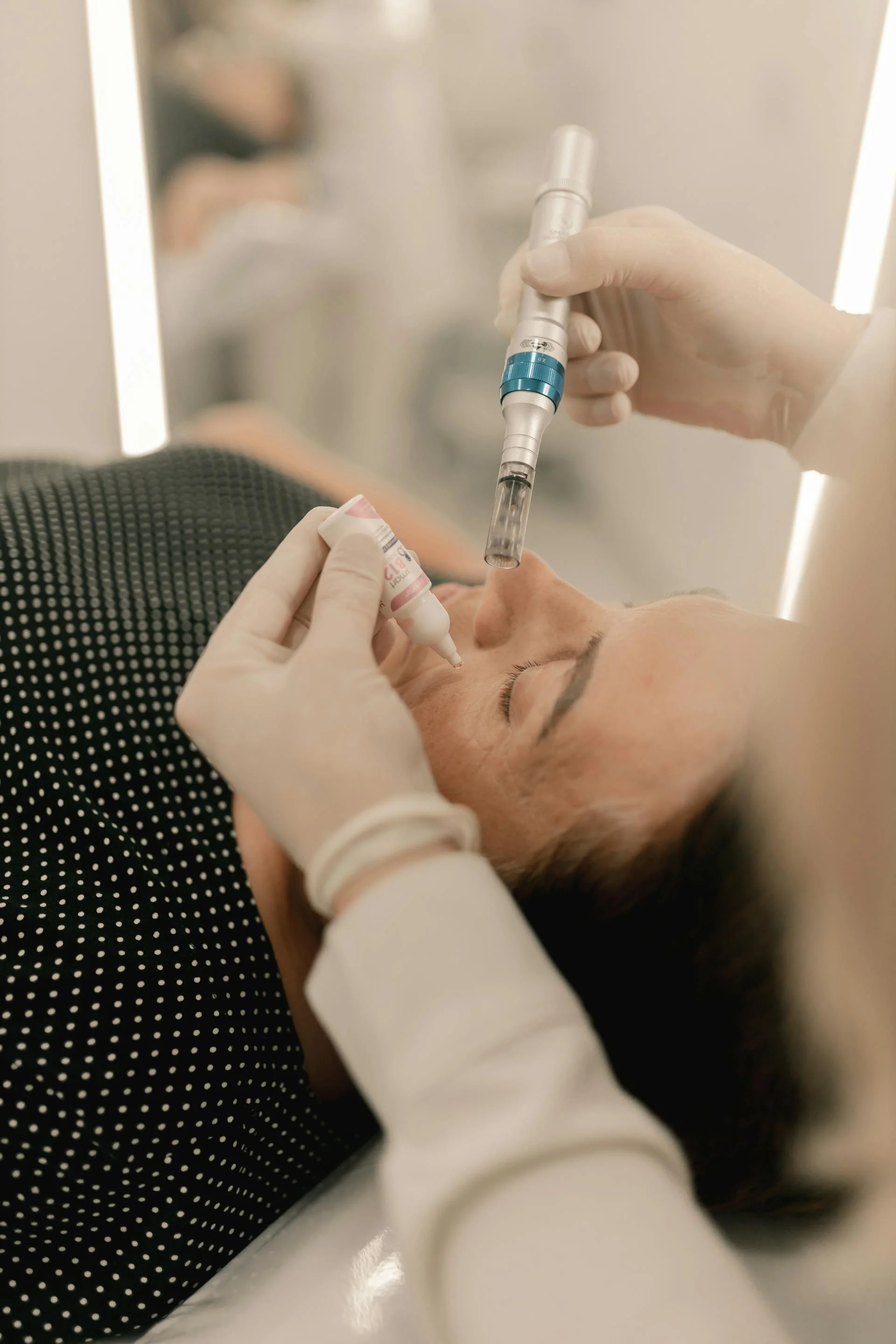 RF microneedling pen device during facial treatment