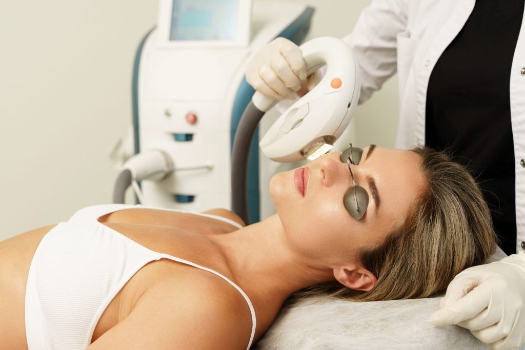 IPL Photofacial